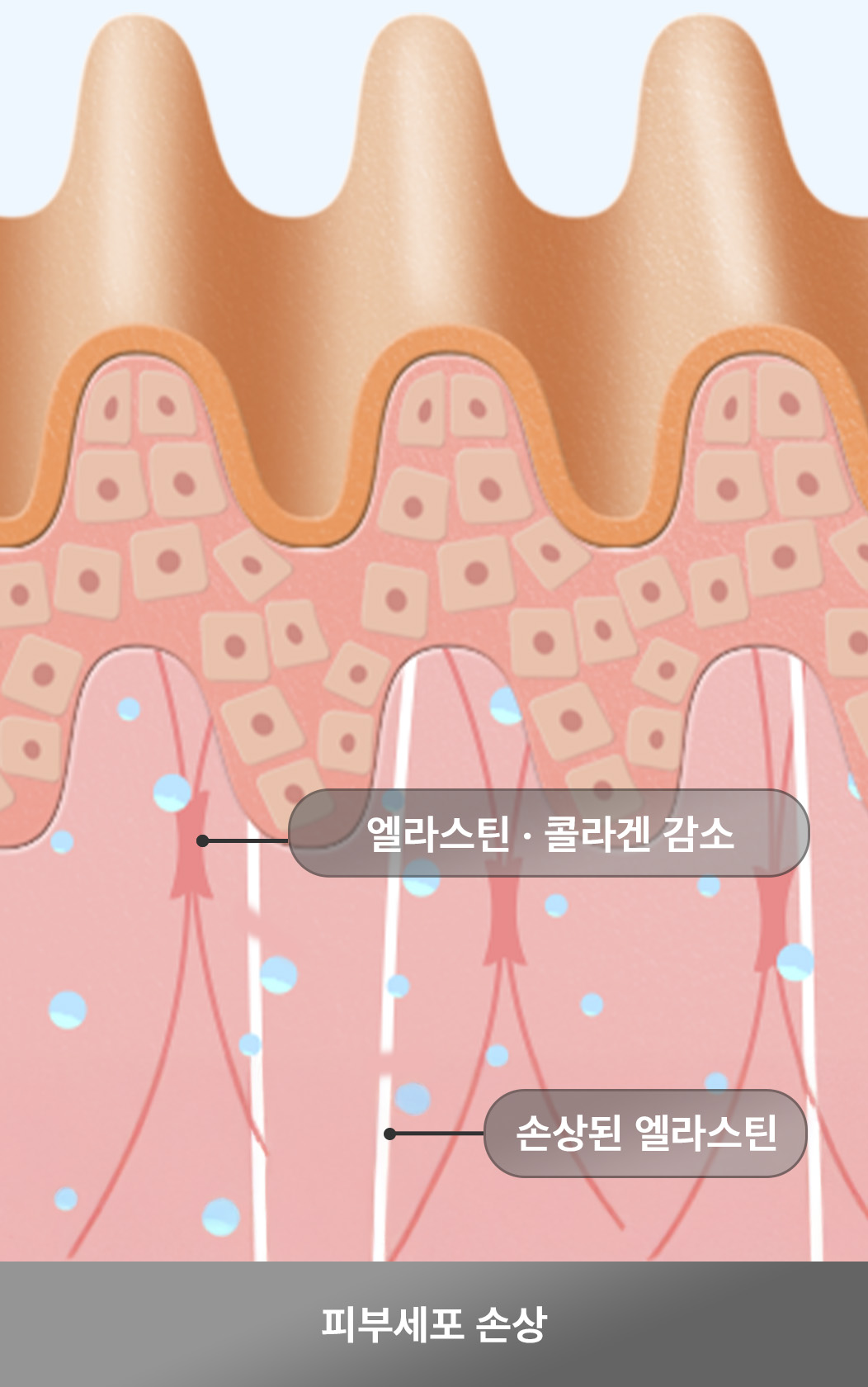 VOSTEM피부주사 1