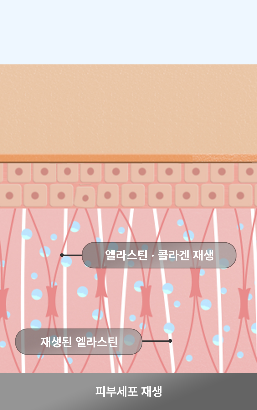 VOSTEM피부주사 2