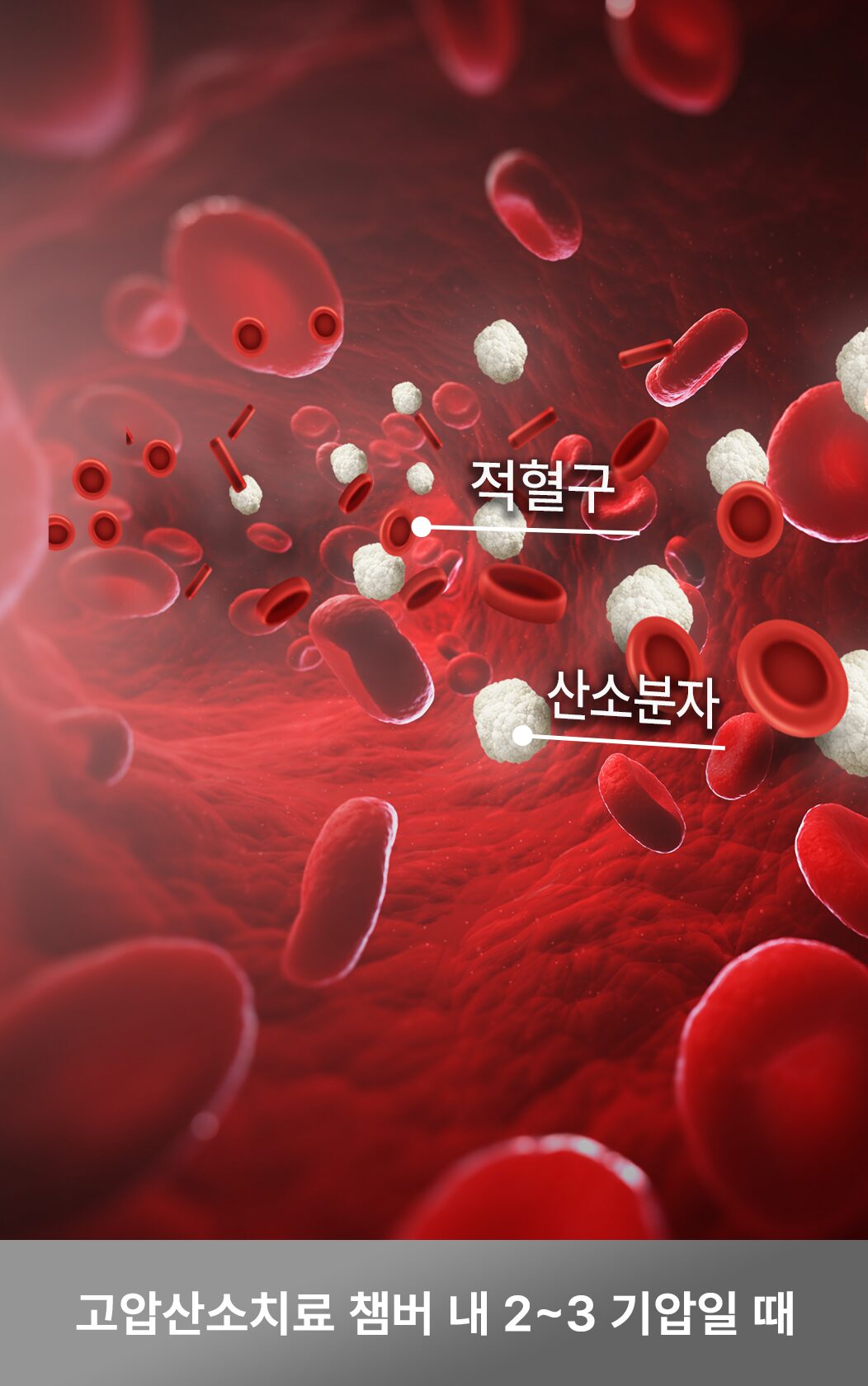 고압산소