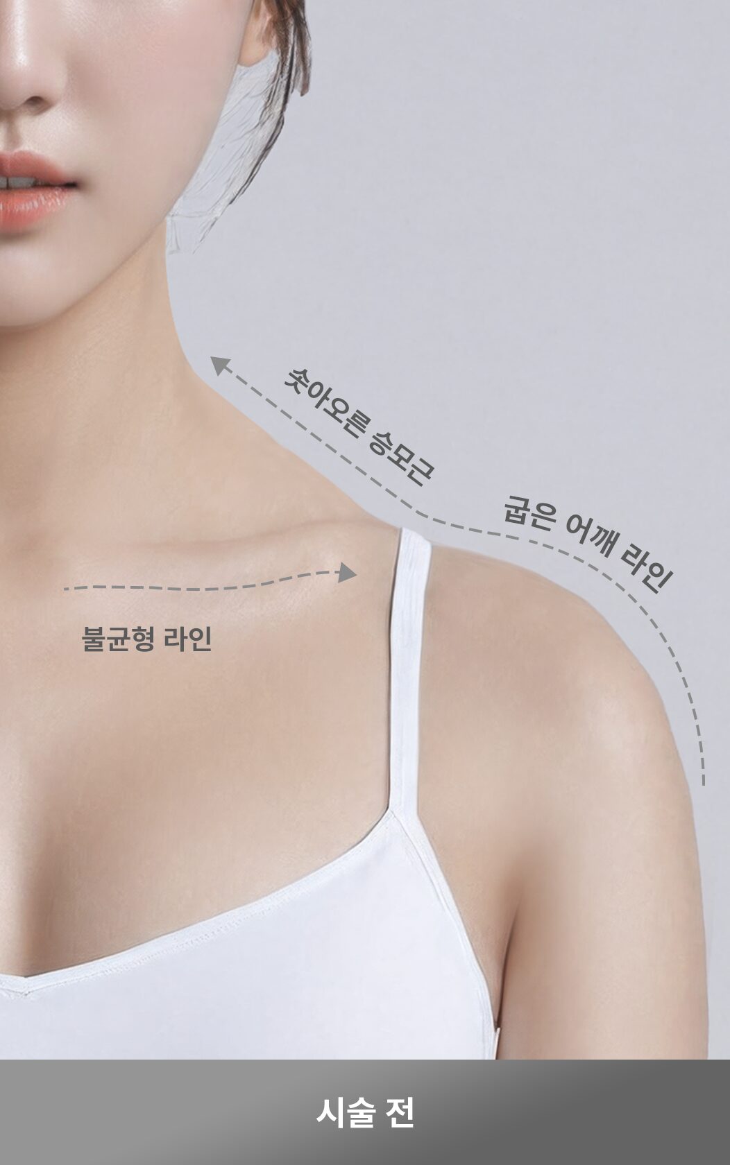 시술전