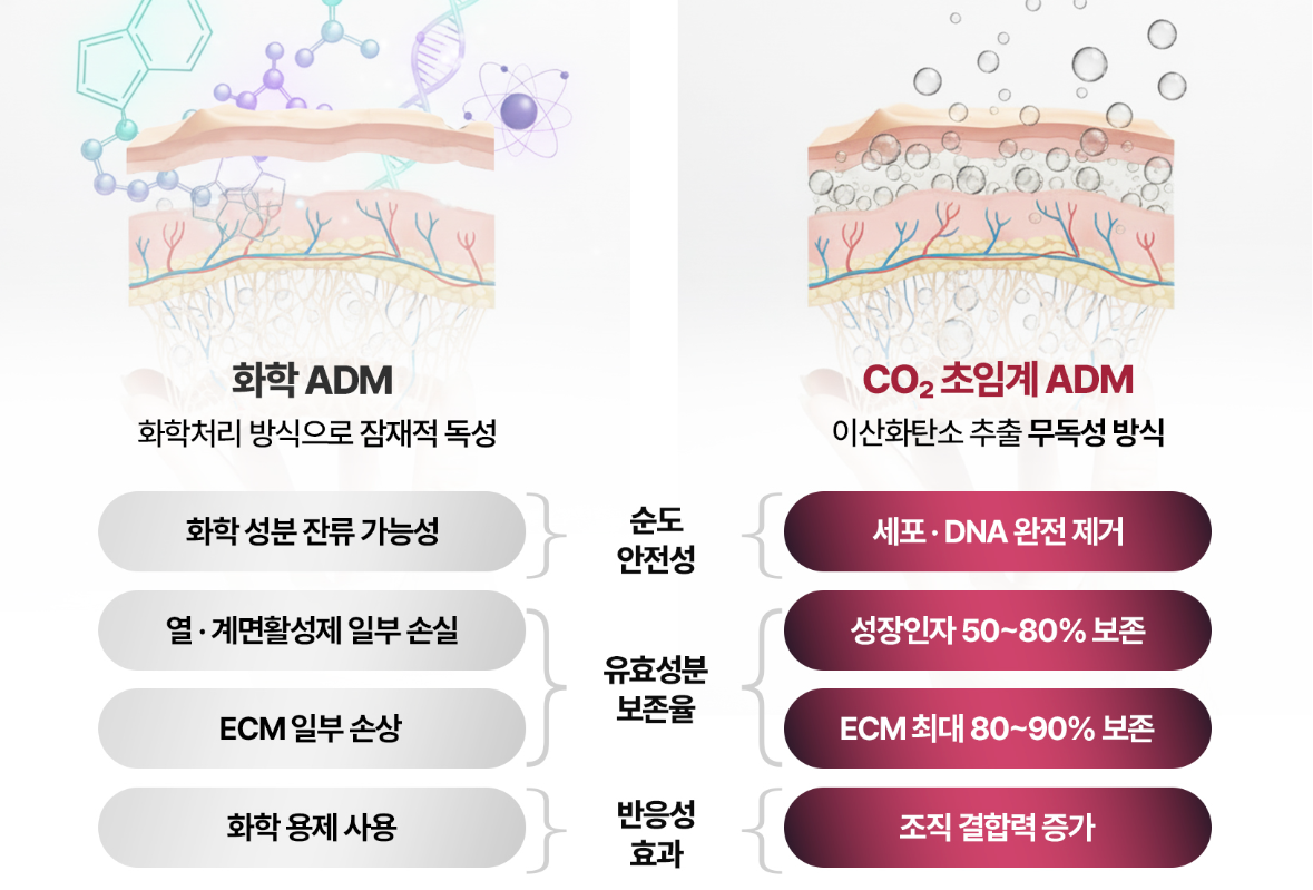 쥬브아셀 눈밑 꺼짐 시술 구조 설명